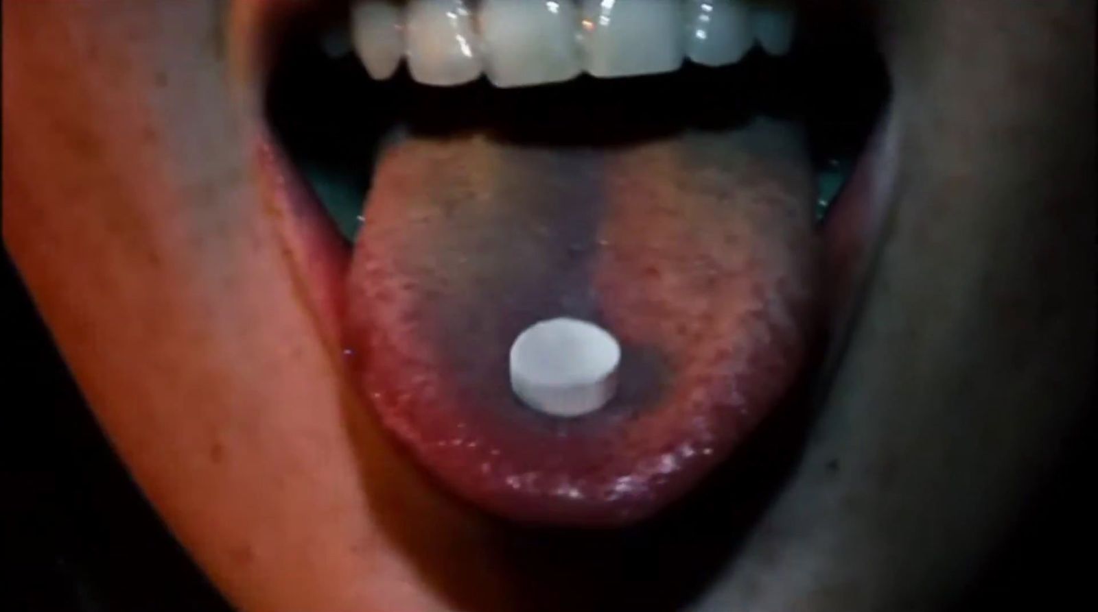 a close up of a person's mouth with a pill in it