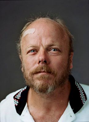 a man with a white patch on his forehead