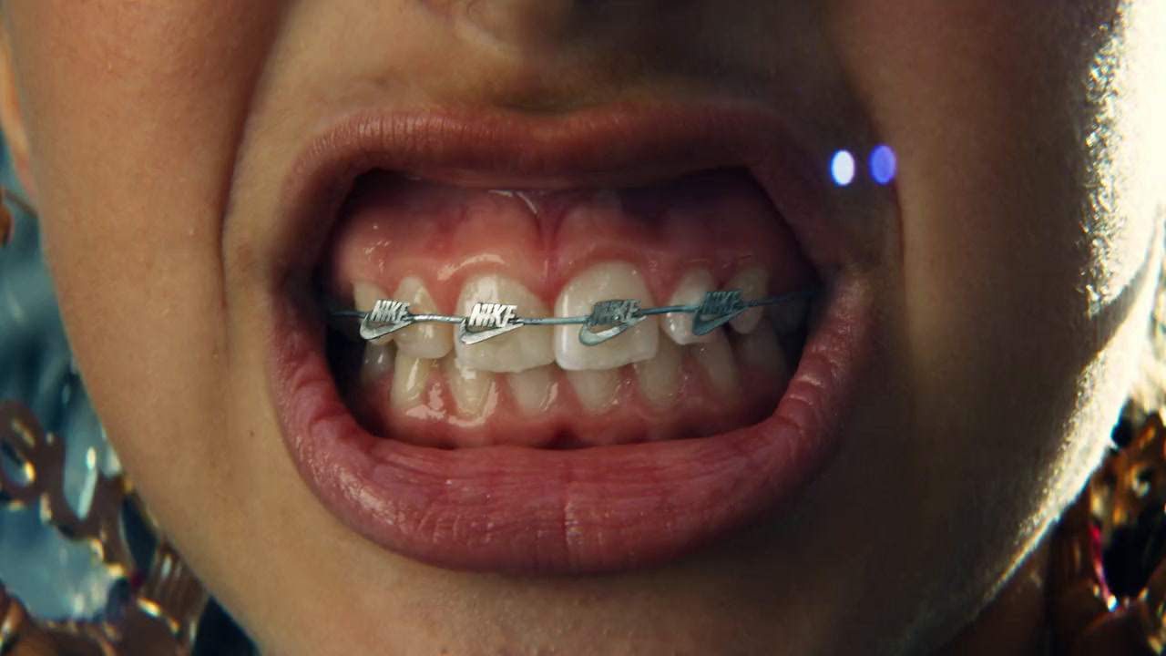 a close up of a person with braces on their teeth