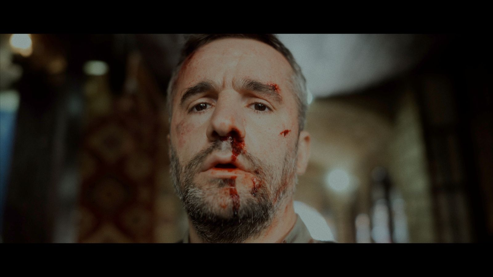 a man with blood on his face looking at the camera