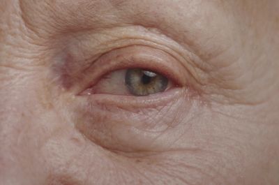 a close up of a person's eye with wrinkles