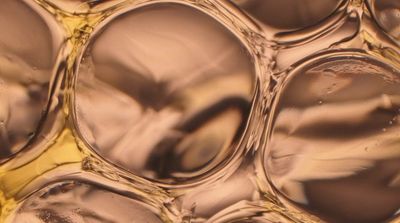 a close up view of a liquid filled with bubbles