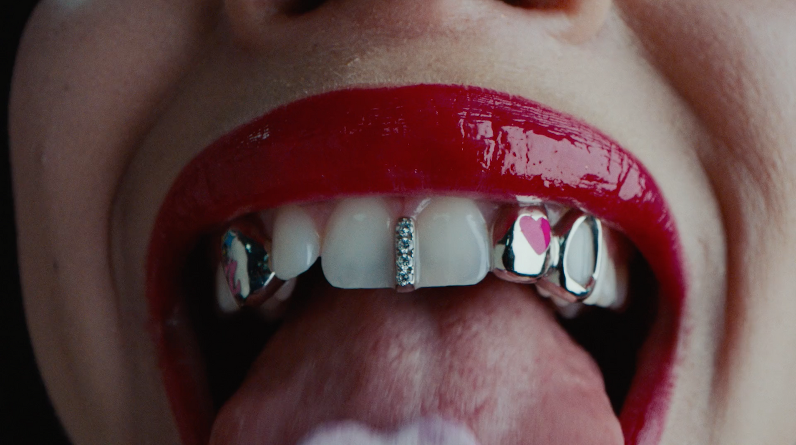 a close up of a woman's mouth with braces on it