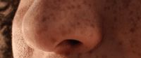 a close up of a person's nose and nose