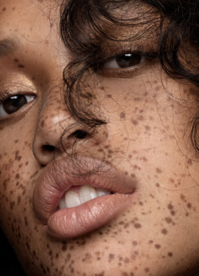 a close up of a woman with freckles on her face