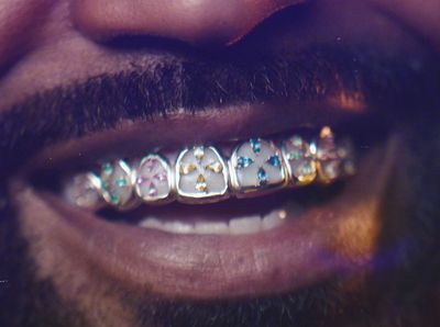 a close up of a man's mouth with a metal brace