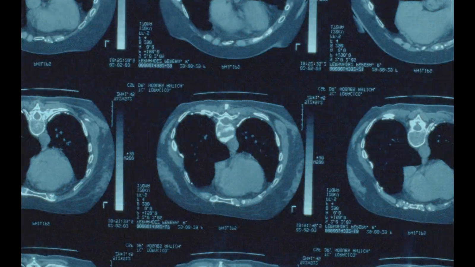 an x - ray of a person's stomach with multiple sections of the stomach