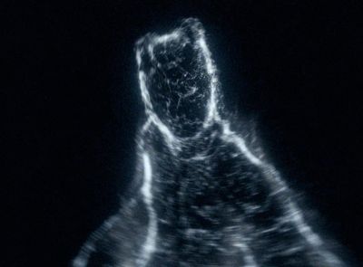 a black and white image of a person in the dark