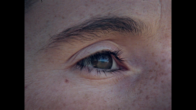 a close up of a person's eye with freckles