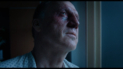 a man with a bloody face looking out of a window