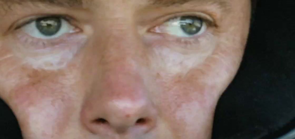 a close up of a person with freckles on their face