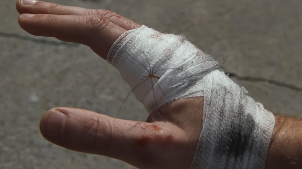 a man's hand with a bandage on it