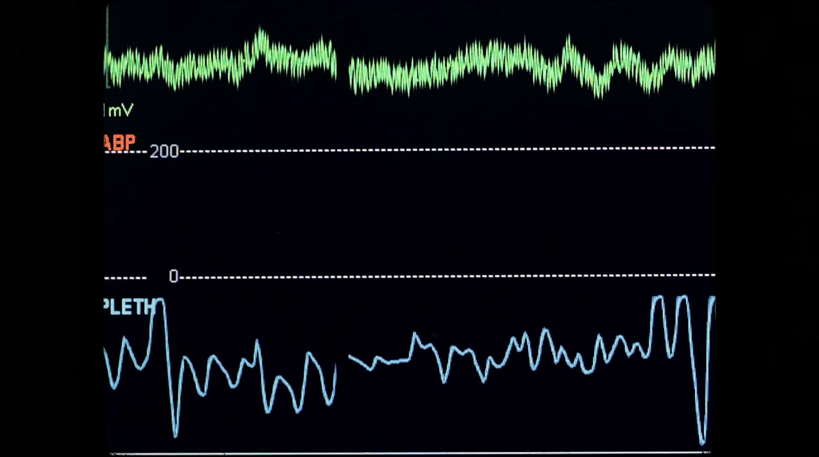 a black background with a line graph and a black background with a line graph