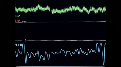 a black background with a line graph and a black background with a line graph