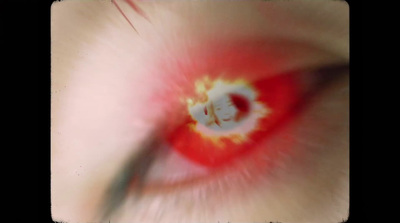 a close up of a persons eye with a red eyeball