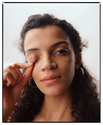 a woman holding her nose to her eye