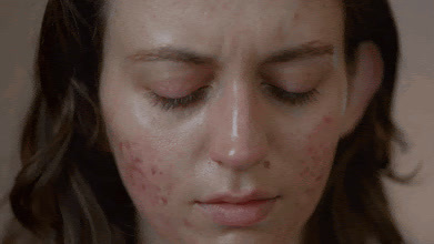 a woman with freckles on her face looking down