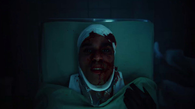 a man in a hospital bed with blood on his face