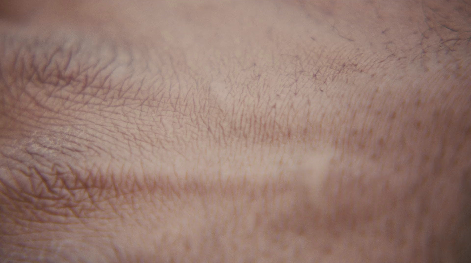 a close up view of a person's skin