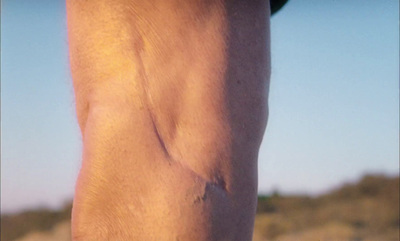 a close up of a person's leg with a piece of skin on it