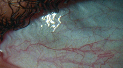 a close up view of a person's eye