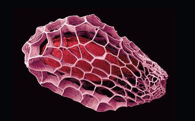 a blood vessel is shown in this image