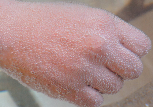 a close up of a person's foot with water droplets on it