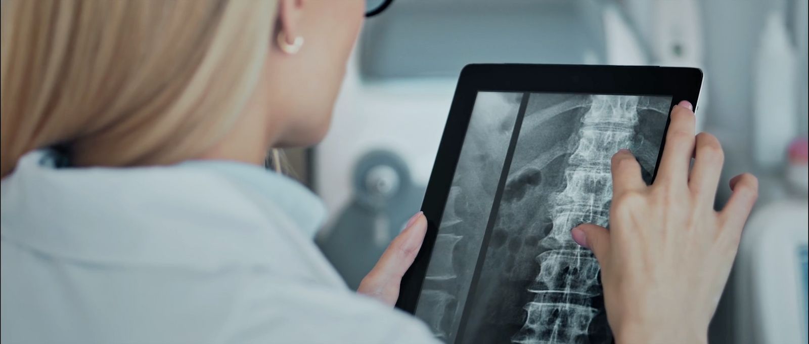 a woman looking at a x - ray image on a tablet