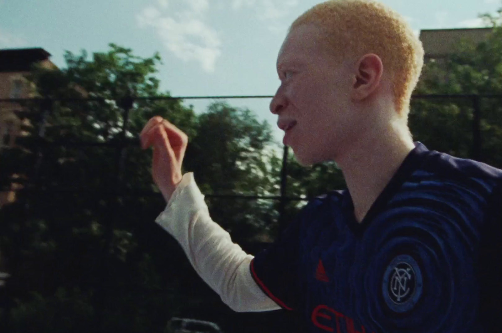 a man with a cast on his arm holding a tennis racquet