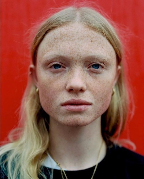 a woman with freckled hair and blue eyes