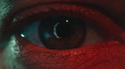 a close up of a person's eye with blood on it