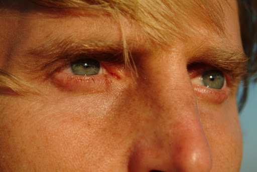 a close up of a man's face with blue eyes