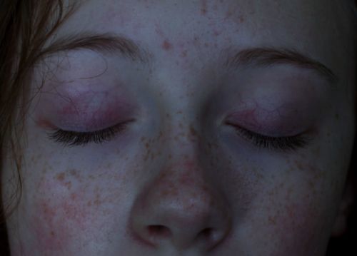 a close up of a woman with freckles on her face