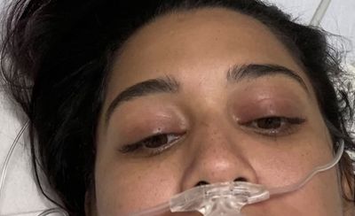 a close up of a person with an oxygen tube in her mouth