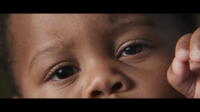 a close up of a child's face with one eye open