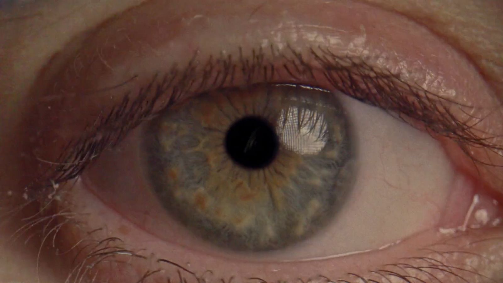 a close up of a person's blue eye