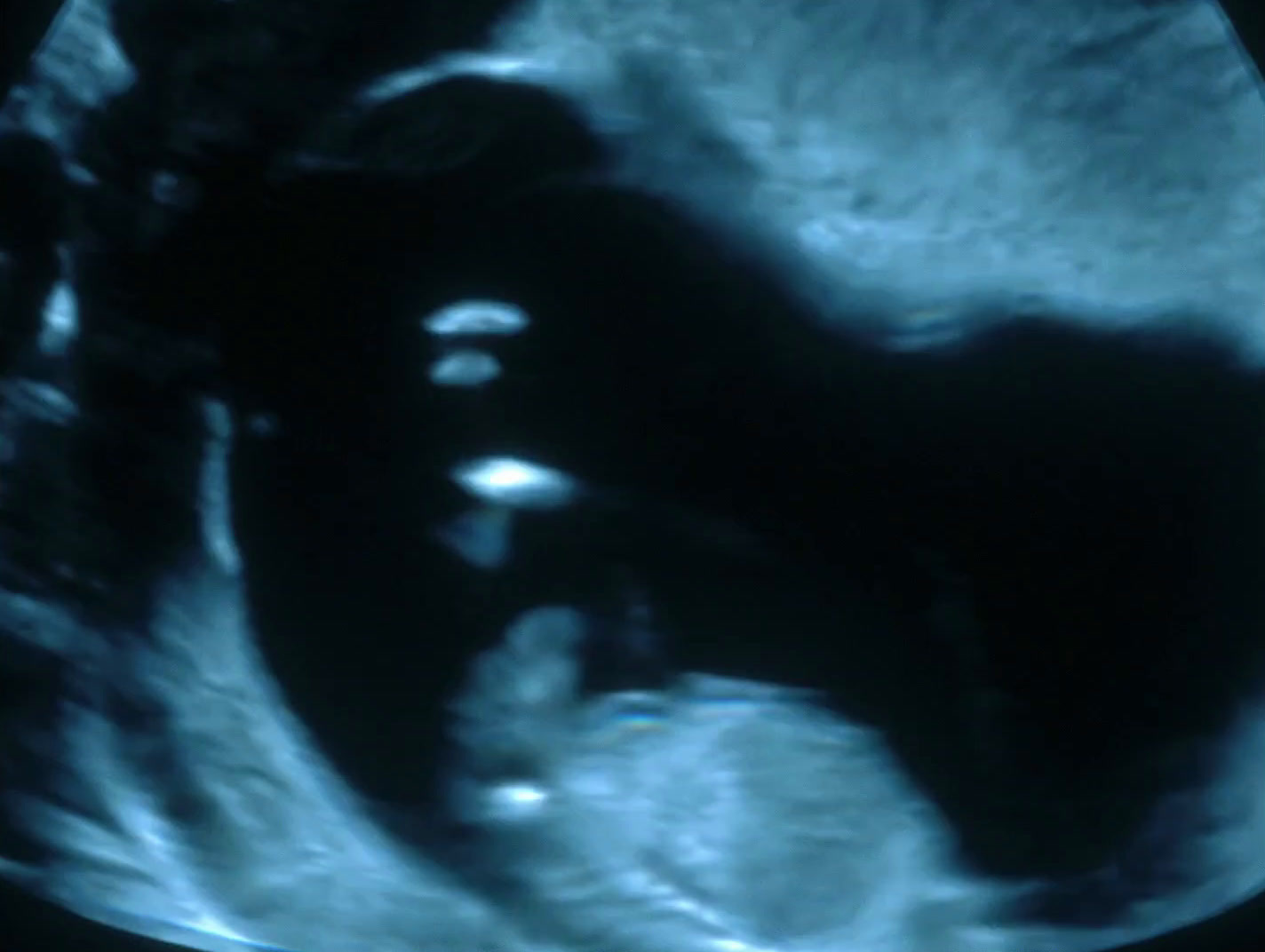 a close up of a person's stomach in the dark