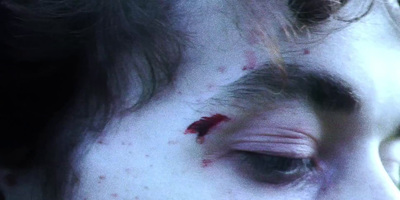 a close up of a person with a bleeding eye